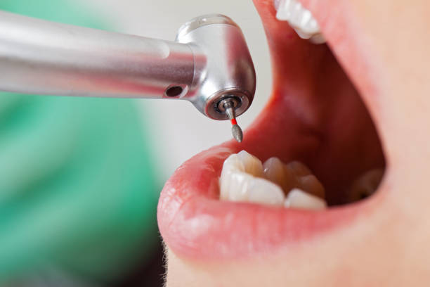 Best Weekend Emergency Dentist in Cordaville, MA